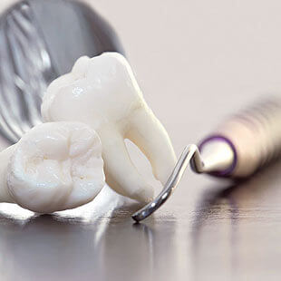 img-EXTRACTIONS