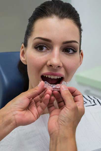 invisalign-can-help-you-img